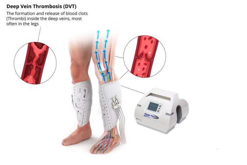 What treatment is given ?