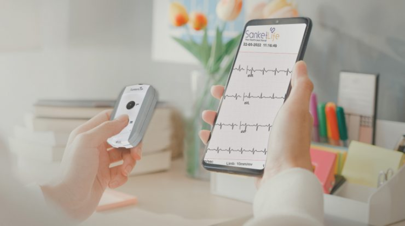 What Are 3 Types of ECG Monitoring?