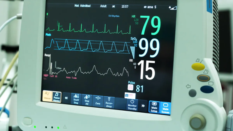 What Is the Difference Between Cardiac Monitoring and a 12 Lead EKG?