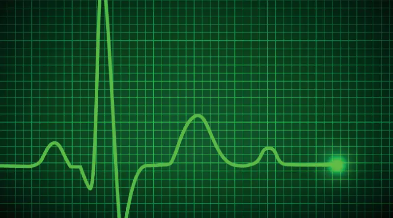 Pulse rate (PR)